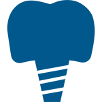 Implante Dentário