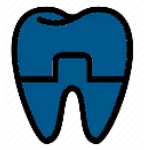 Lentes de Contato Dental